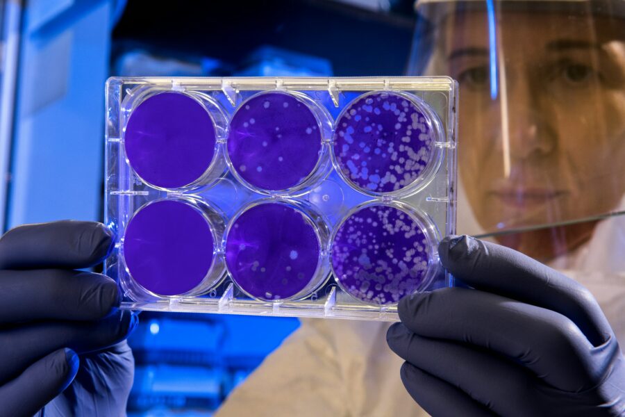 From personal struggle to global crisis: the rising threat of antibiotic resistance Hodowla mikrobiologiczna - płytka